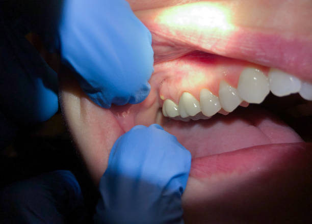 Best Same-Day Emergency Dental Services in Dooms, VA